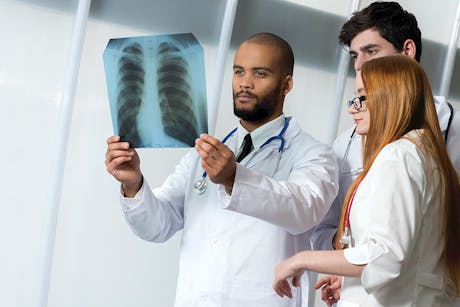Doctors examining a CT Scan from a lung cancer screening.